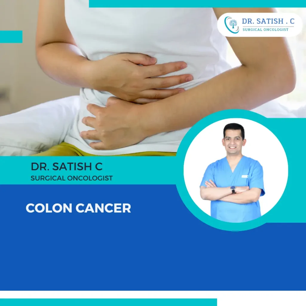 Best Colon Cancer Treatment in Bangalore