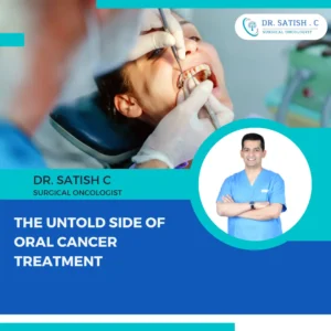 Best Oral Cancer Surgeon in Bangalore