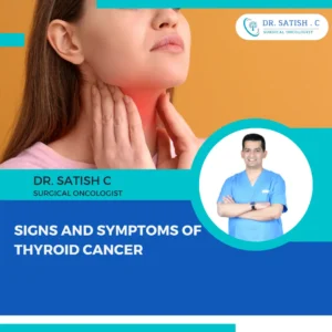 Thyroid Cancer Doctor in Bangalore