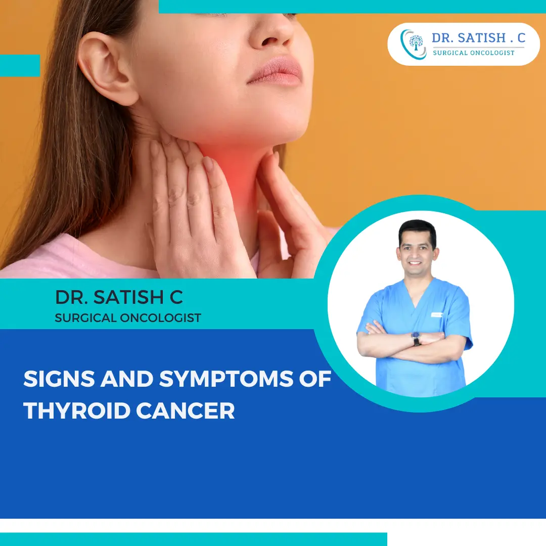 Thyroid Cancer Doctor in Bangalore