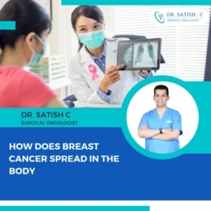 Breast Cancer Surgeon in Bangalore