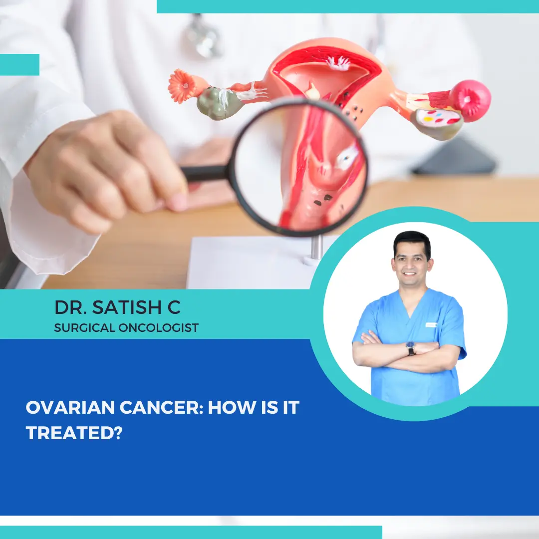 Ovarian Cancer Surgeon in Bangalore