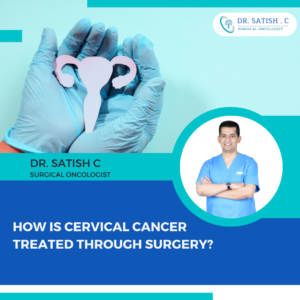 Cervical Cancer Surgery, Best surgical oncologist in Jayanagar, Bangalore - Dr. Satish C