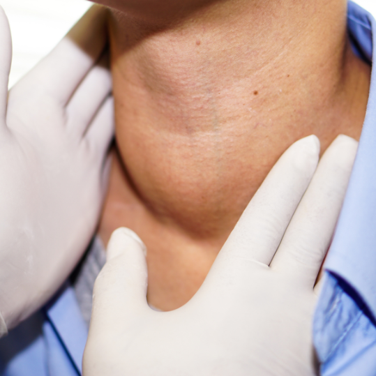 Retrosternal Thyroid Surgery