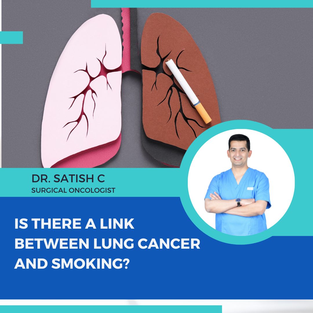 Lung Cancer Doctor in Bangalore | Dr.Satish.C