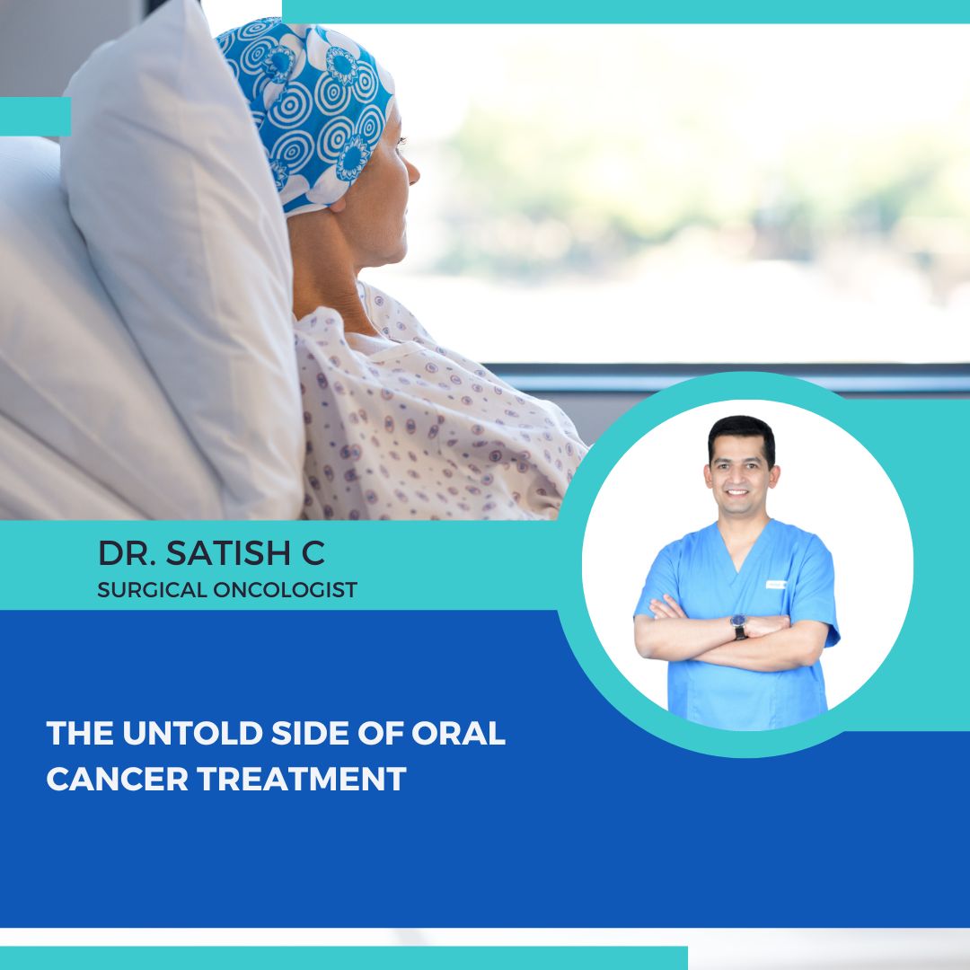 Cancer Care Specialist in Bangalore | Dr. Satish C