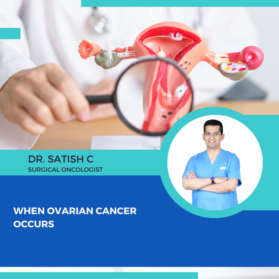 Surgical Oncologist in JP Nagar, Bangalore | Dr.Satish.C