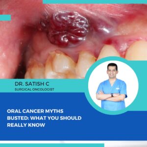 Surgical Oncologist in Bengaluru | Dr.Satish.C