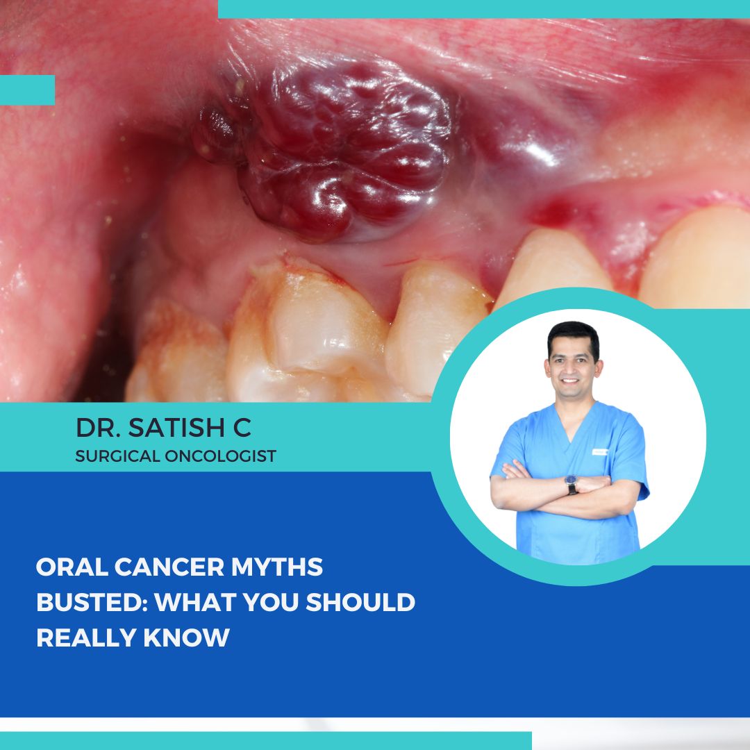 Surgical Oncologist in Bengaluru | Dr.Satish.C