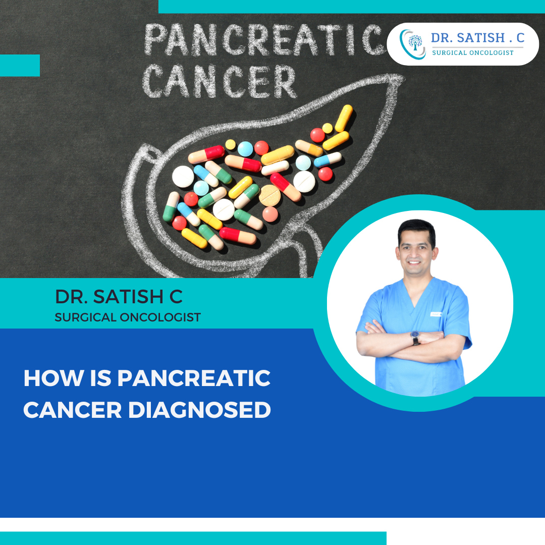 Gastrointestinal Cancer Specialist in Bangalore | Dr. Satish. C