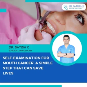 Best Mouth Cancer Surgeon in Bangalore