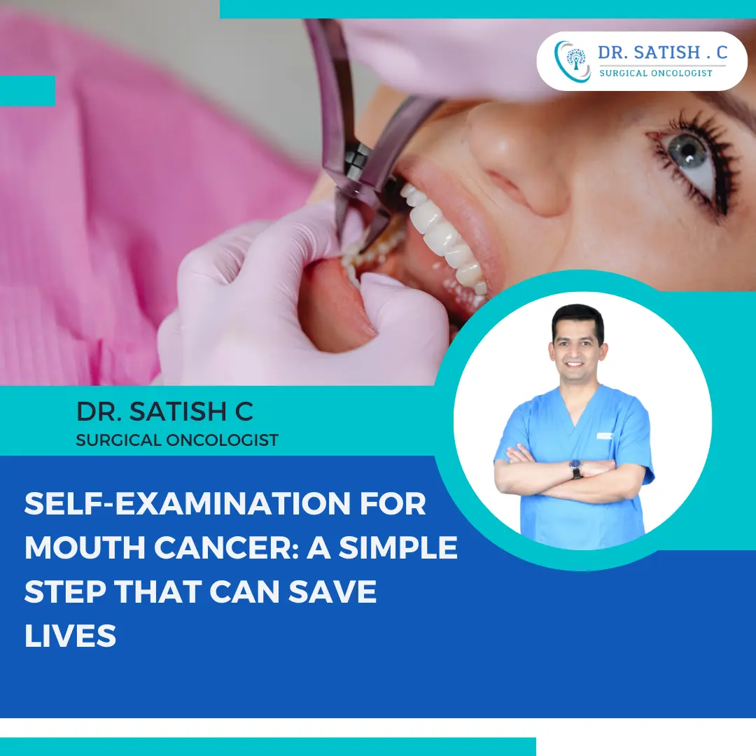Best Mouth Cancer Surgeon in Bangalore