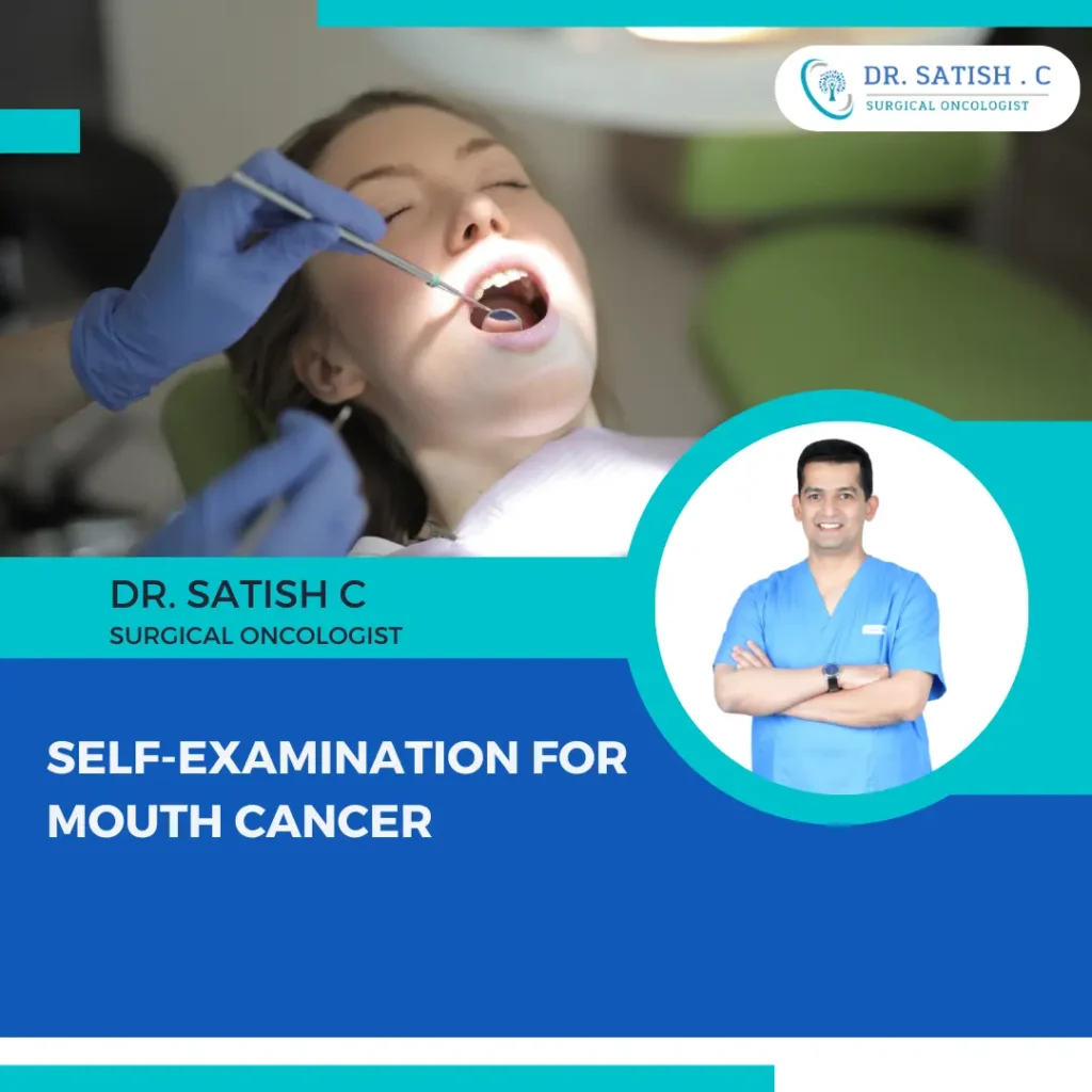 Mouth Cancer Treatment in Bangalore