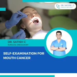 Mouth Cancer Treatment in Bangalore