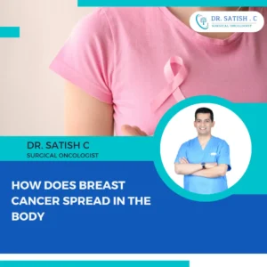 Breast Cancer Surgeon in Bangalore