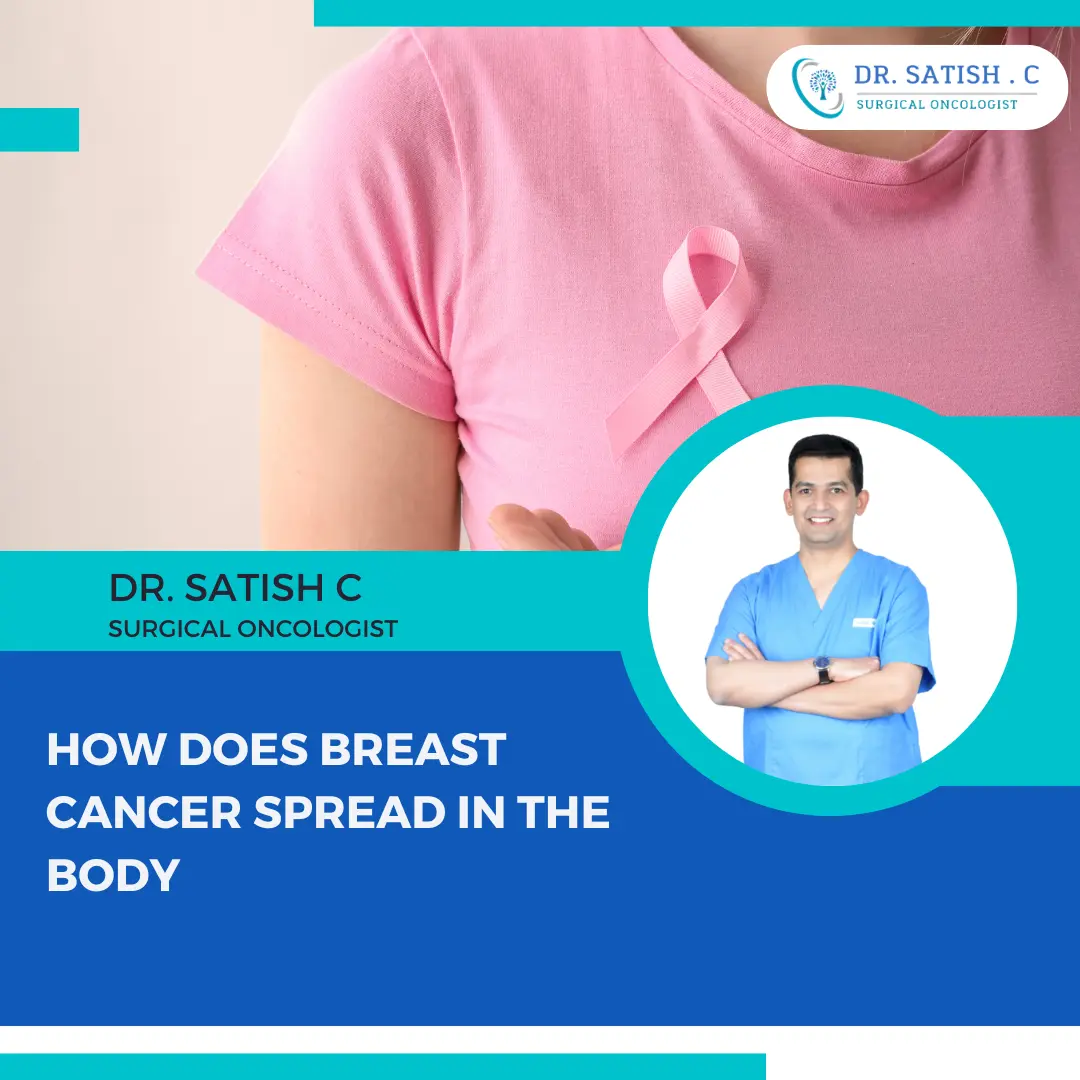 Breast Cancer Surgeon in Bangalore