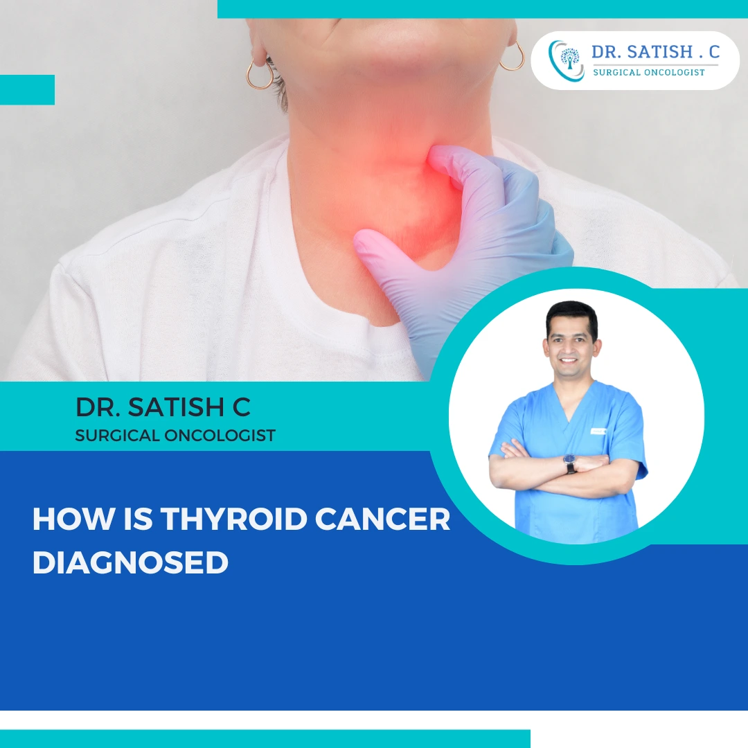 Best Thyroid Cancer Treatment In Bangalore