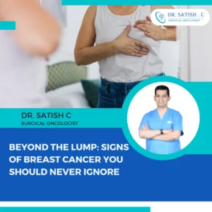 Breast Cancer Surgeon in Bangalore