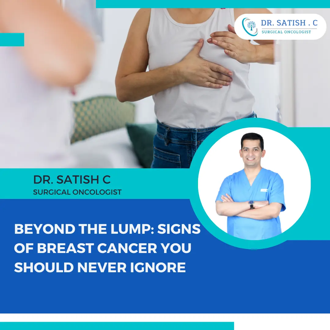 Breast Cancer Surgeon in Bangalore