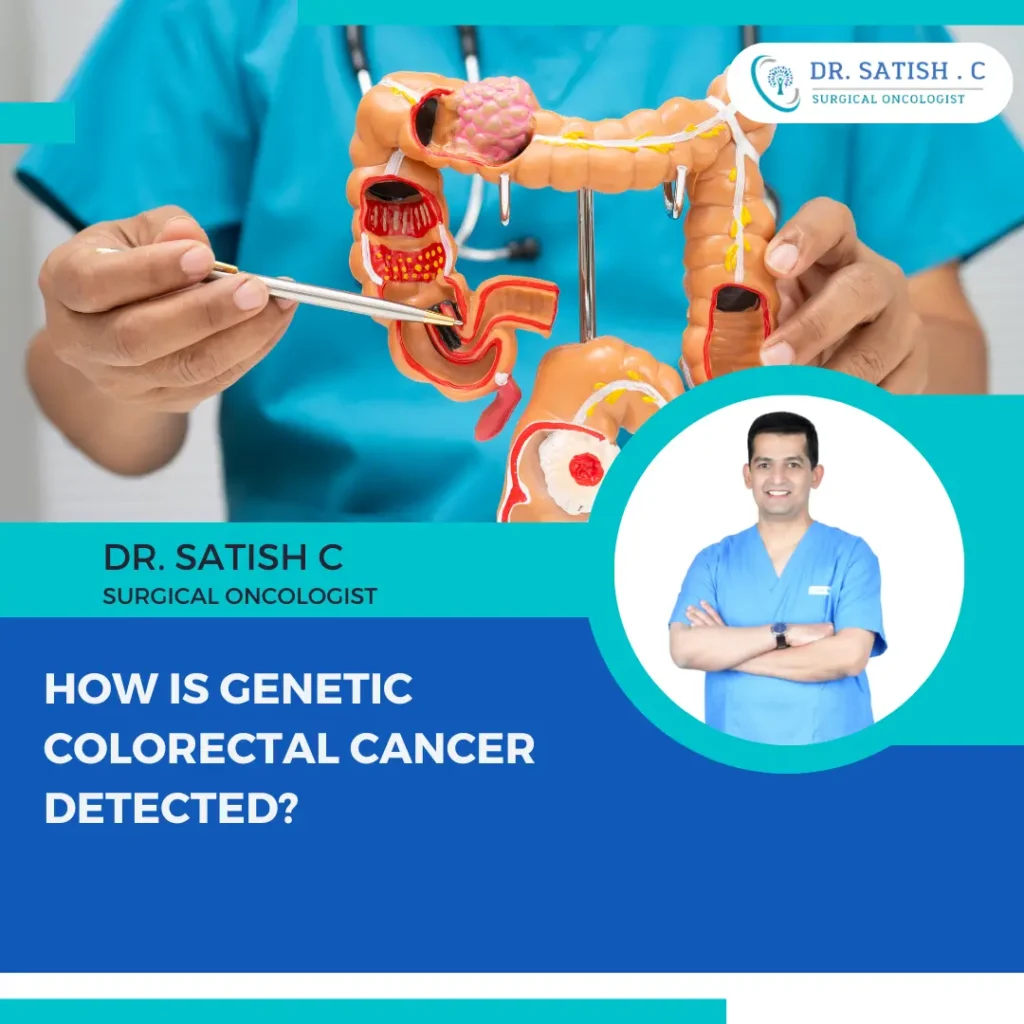 Colorectal Cancer Specialist in Bangalore